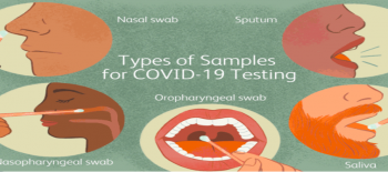 Does Sample Type Affect COVID-19 Testing Results?