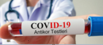 COVİD-19 ANTİKOR TESTİ
