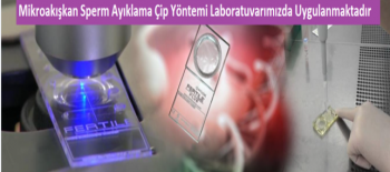 Mikroakışkan Sperm Ayıklama Çip Yöntemi Laboratuvarımızda Uygulanmaktadır