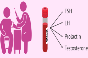 Erkek Hormon Testleri