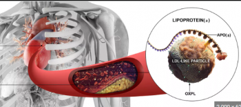 Yüksek Lp(a) seviyeleri sağlık için kötü müdür?