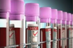 HIV Testleri Nelerdir? Bulaş Riskinden Sonra Ne Zaman Yaptırabilirim?
