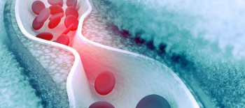 Apolipoprotein B (Apo B) Testi Nedir?