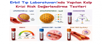 Kalp-Damar/Metabolik Riskin Daha Ayrıntılı Değerlendirilmesinde Kullanılan Kan Testleri