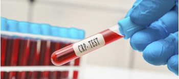 C-reaktif protein:Sağlıklı kişilerin de bu protein için test edilmesi gerekir mi?
